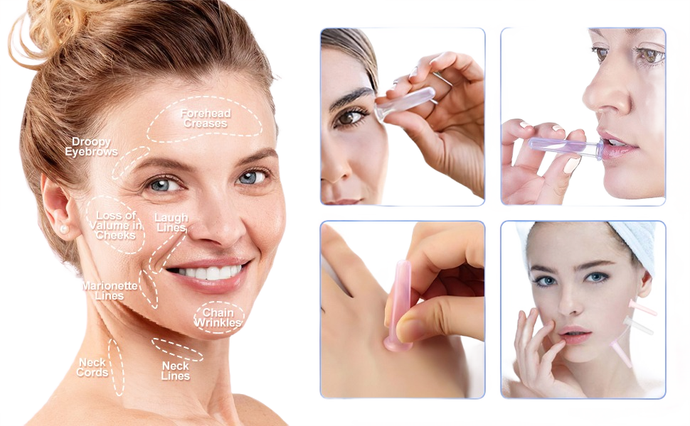 Traditional-Chinese-Facial-Cupping-1.webp