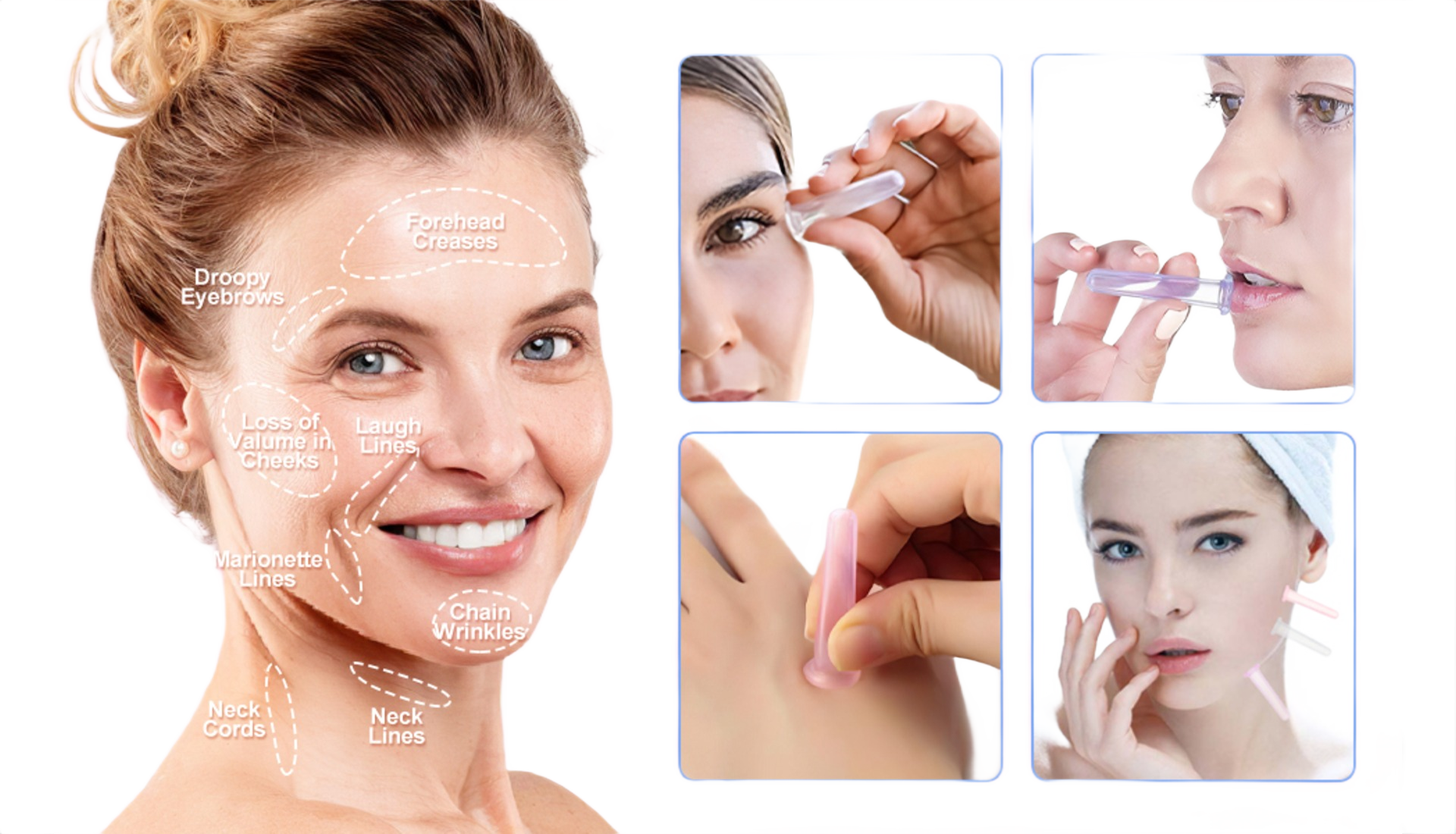 Facial Cupping