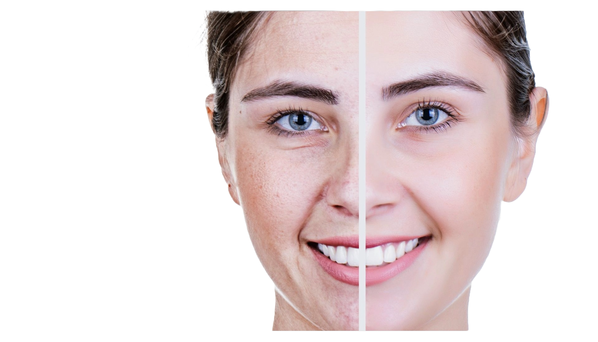 Skin Rejuvenation Facial Treatments
